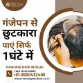 Hair Wig Shop in Delhi - Get rid of baldness in just 1 hour